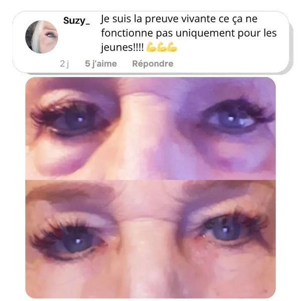 Glowmoon | Appareil Soin Contour des Yeux | Anti-Poches sous les yeux & Anti-Cernes