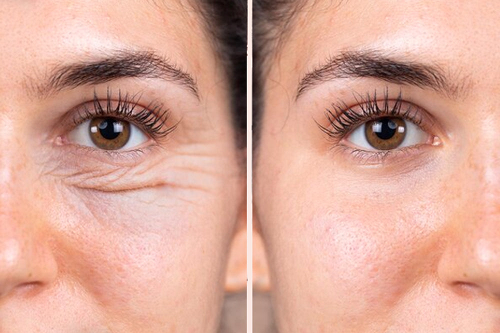 Anti rides - Anti cernes - Anti poches - lumière rouge