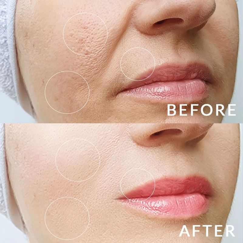 Glowlift | Appareil de beauté premium